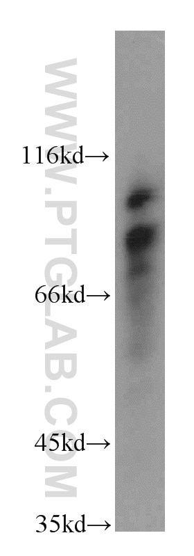 Western Blot (WB) analysis of human heart tissue using MYLK3 Polyclonal antibody (21527-1-AP)