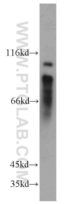 Western Blot (WB) analysis of human heart tissue using MYLK3 Polyclonal antibody (21527-1-AP)