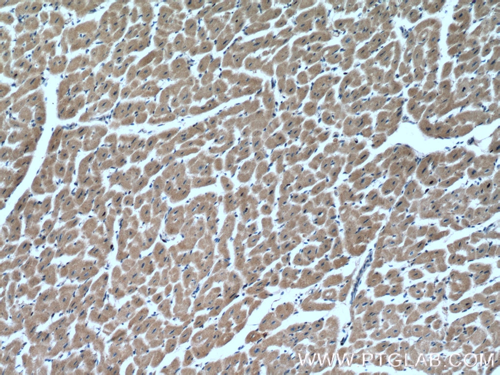 IHC staining of human heart using 24309-1-AP