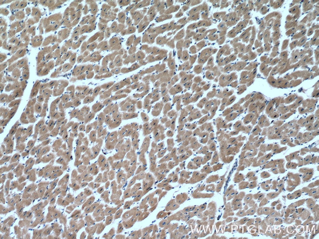 Immunohistochemistry (IHC) staining of human heart tissue using MYLK4 Polyclonal antibody (24309-1-AP)