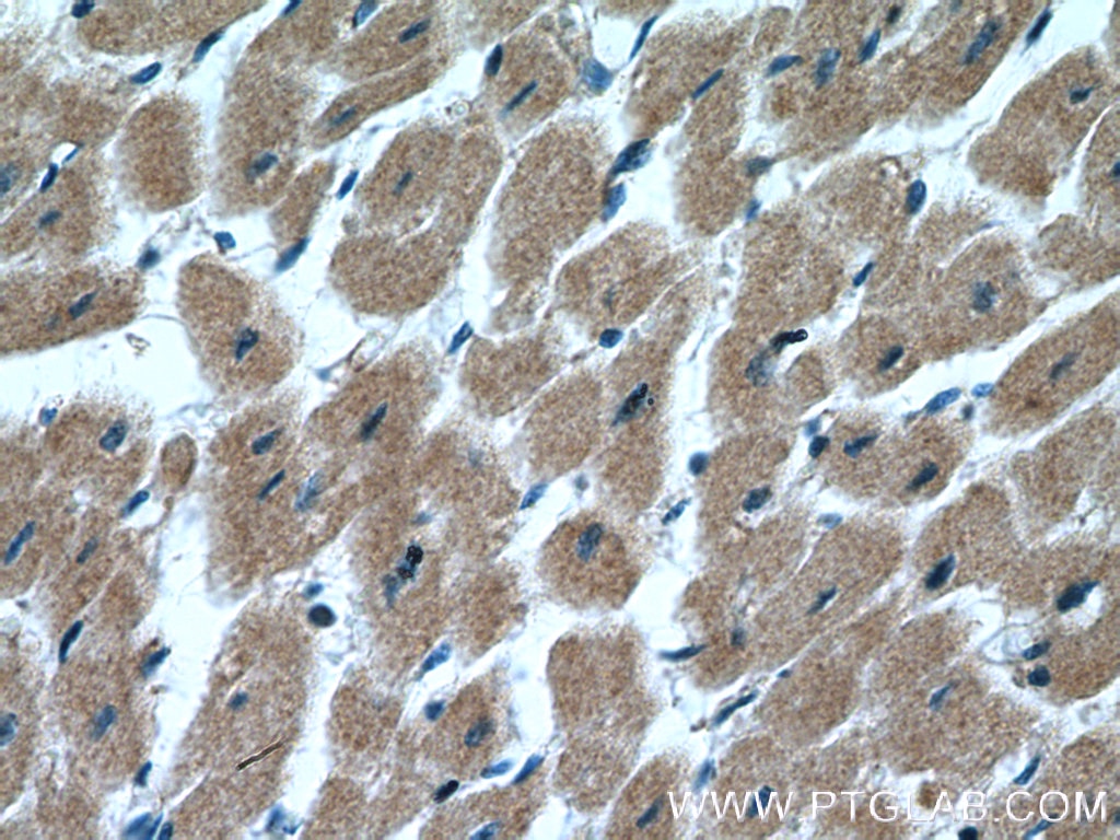 Immunohistochemistry (IHC) staining of human heart tissue using MYLK4 Polyclonal antibody (24309-1-AP)