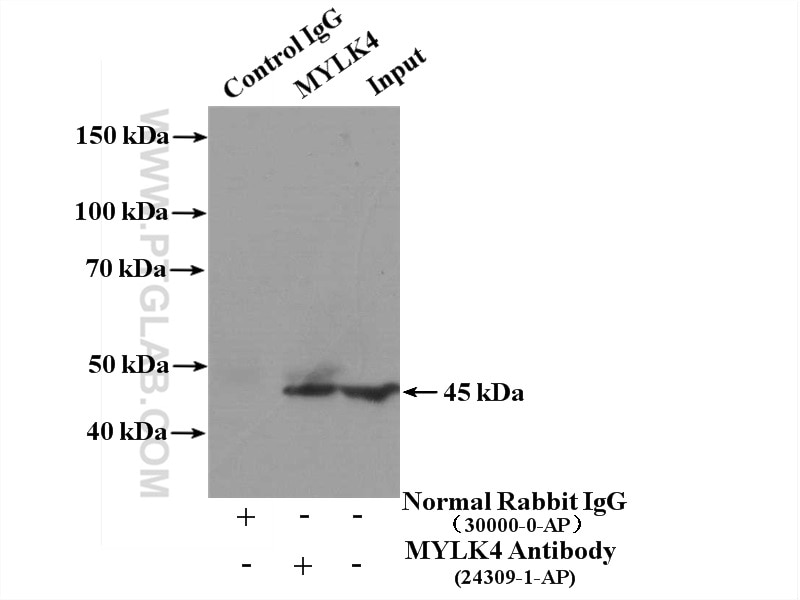Immunoprecipitation (IP) experiment of HEK-293 cells using MYLK4 Polyclonal antibody (24309-1-AP)