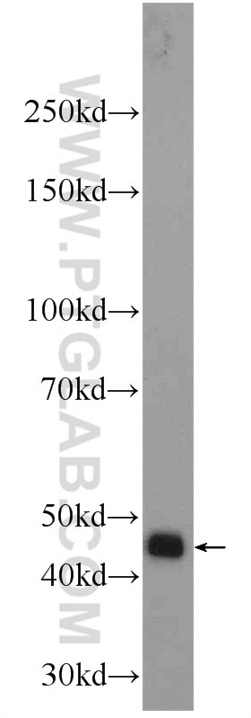 Western Blot (WB) analysis of HEK-293 cells using MYLK4 Polyclonal antibody (24309-1-AP)