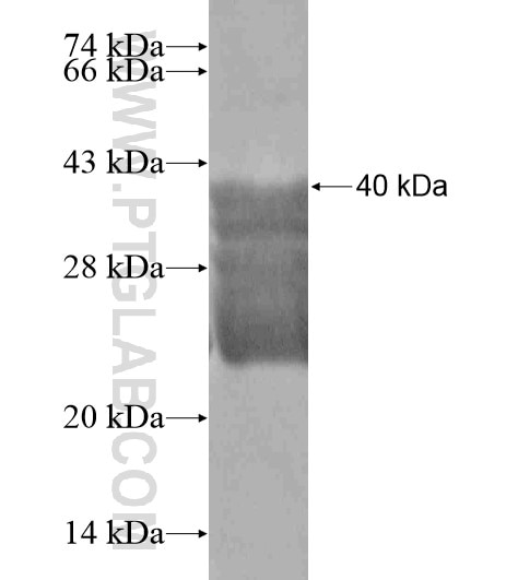 MYLK4 fusion protein Ag19314 SDS-PAGE
