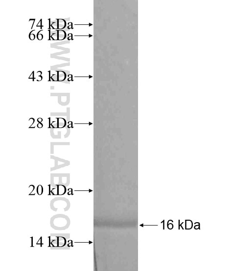 MYLK4 fusion protein Ag19440 SDS-PAGE