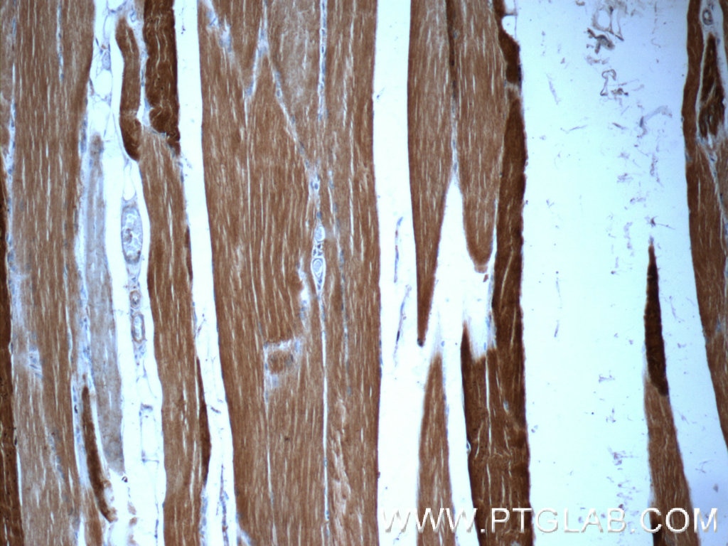 Immunohistochemistry (IHC) staining of human skeletal muscle tissue using MYLPF Polyclonal antibody (16052-1-AP)