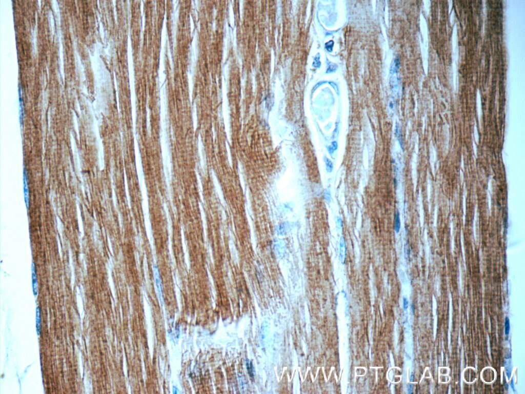 Immunohistochemistry (IHC) staining of human skeletal muscle tissue using MYLPF Polyclonal antibody (16052-1-AP)