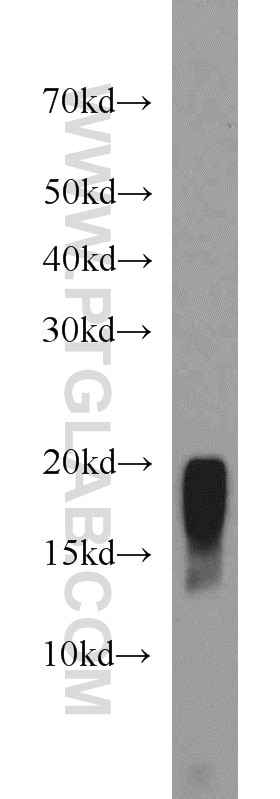 Western Blot (WB) analysis of mouse skeletal muscle tissue using MYLPF Polyclonal antibody (16052-1-AP)