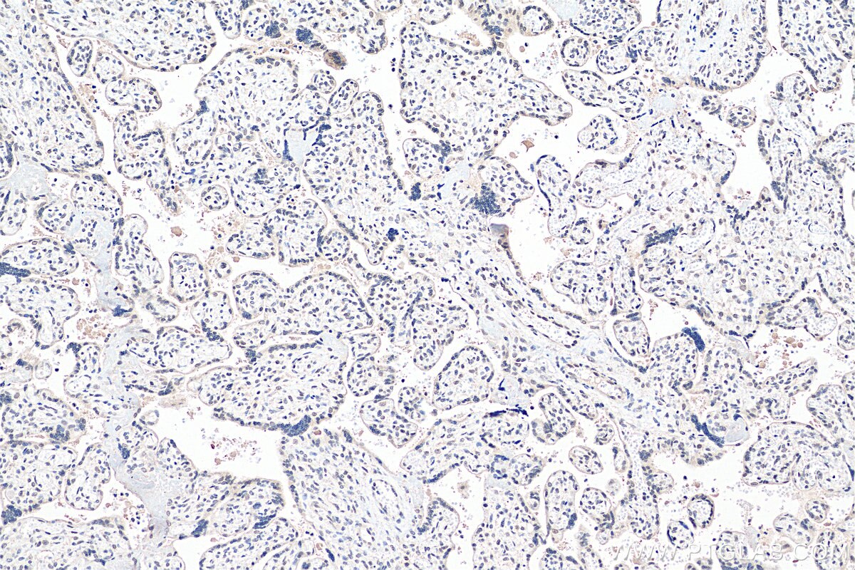 Immunohistochemistry (IHC) staining of human placenta tissue using MYNN Polyclonal antibody (13369-1-AP)