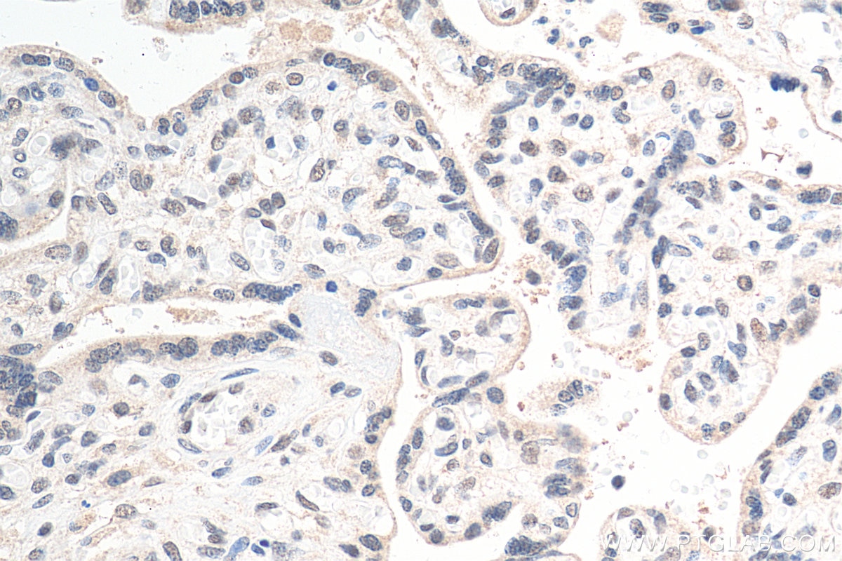Immunohistochemistry (IHC) staining of human placenta tissue using MYNN Polyclonal antibody (13369-1-AP)