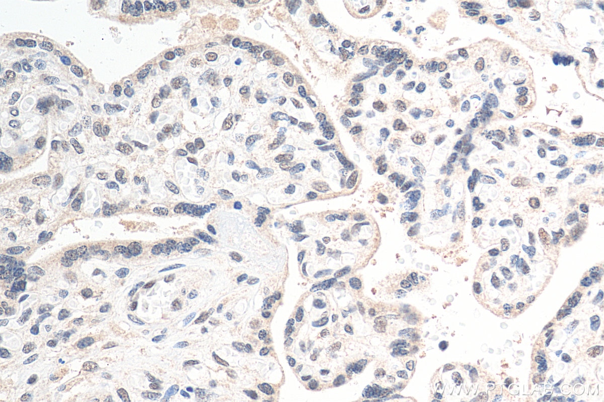 IHC staining of human placenta using 13369-1-AP