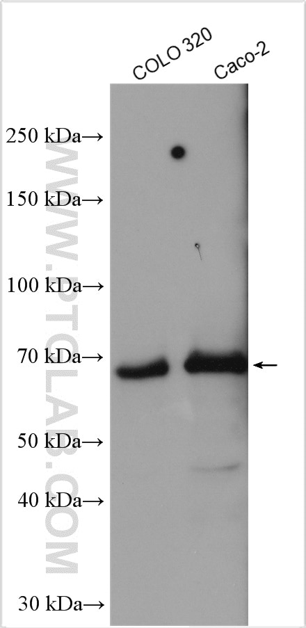 Western Blot (WB) analysis of various lysates using MYNN Polyclonal antibody (13369-1-AP)