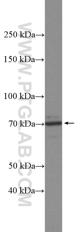 Western Blot (WB) analysis of mouse brain tissue using MYNN Polyclonal antibody (13369-1-AP)