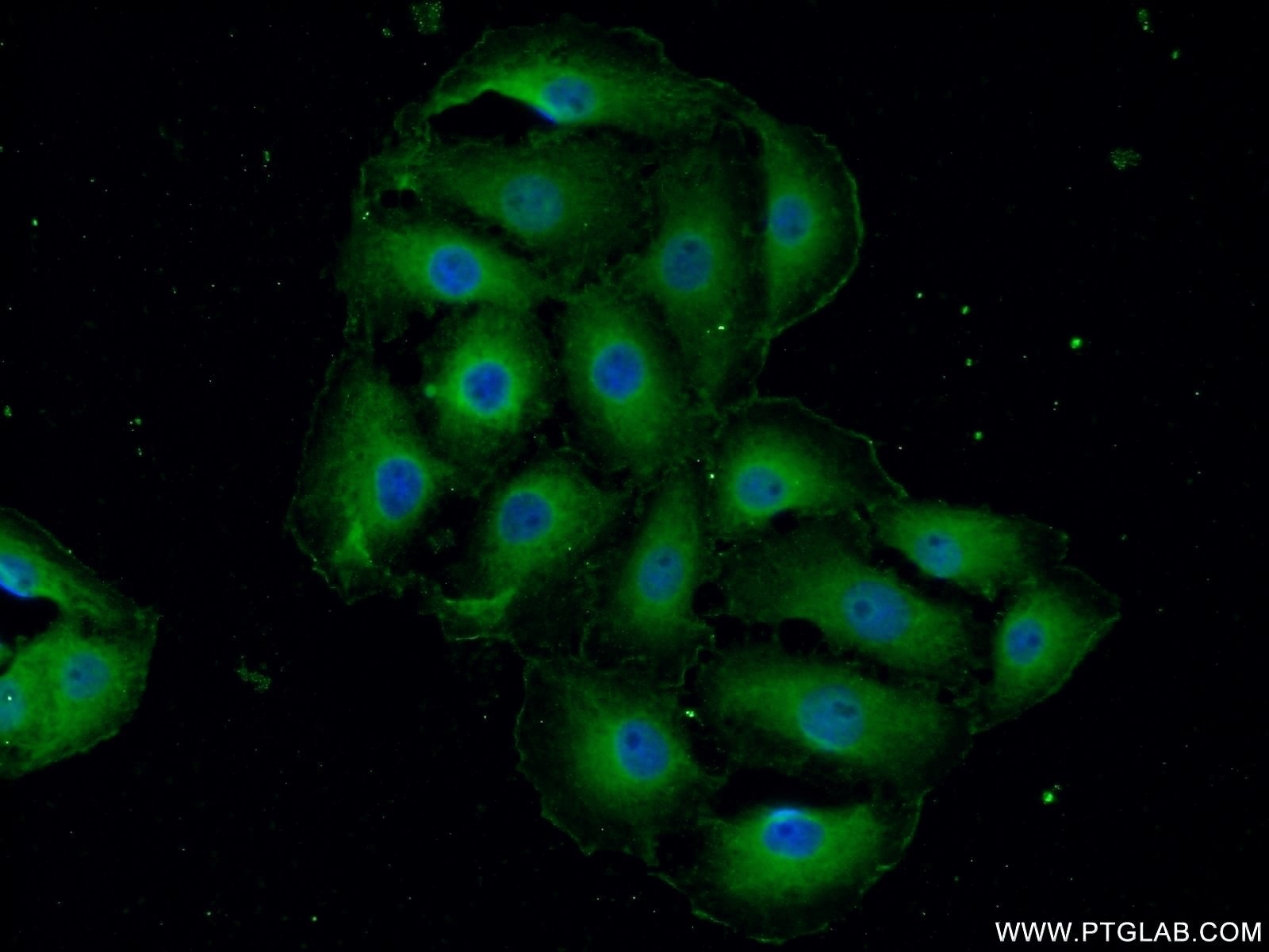 Immunofluorescence (IF) / fluorescent staining of SH-SY5Y cells using MYO10 Polyclonal antibody (24565-1-AP)