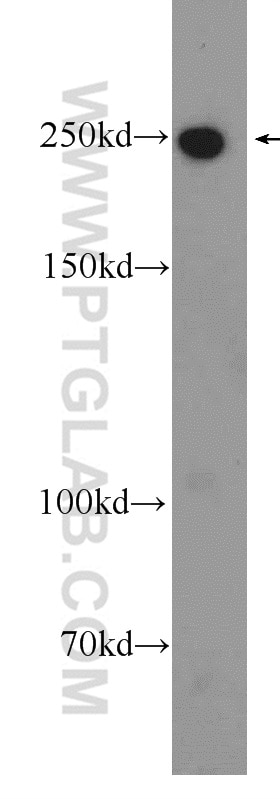 Western Blot (WB) analysis of mouse brain tissue using MYO10 Polyclonal antibody (24565-1-AP)