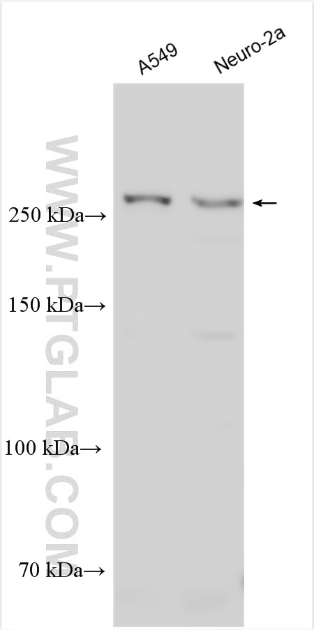 Western Blot (WB) analysis of various lysates using MYO10 Polyclonal antibody (24565-1-AP)