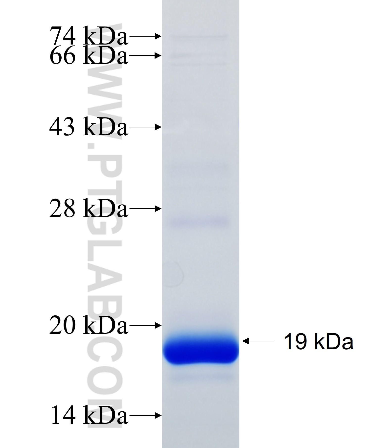 MYO15A fusion protein Ag34823 SDS-PAGE MYO15A fusion protein Ag34823 SDS-PAGE