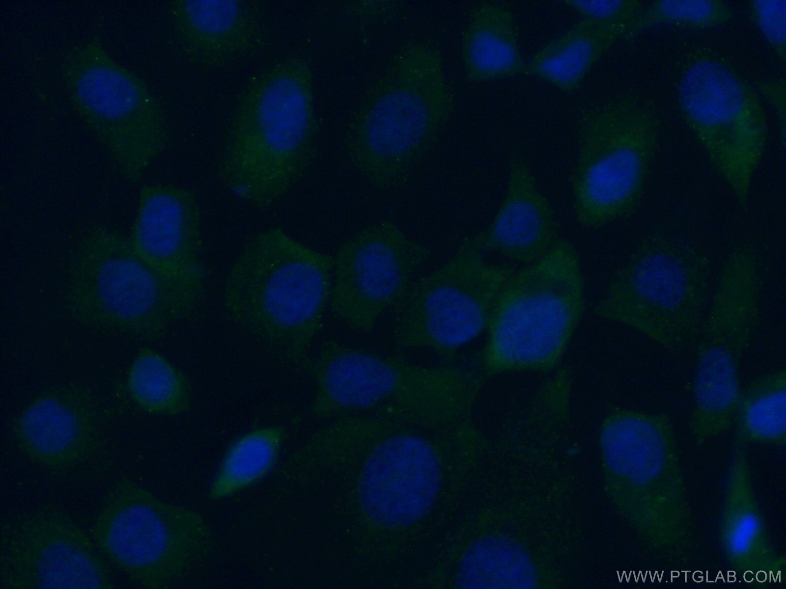 Immunofluorescence (IF) / fluorescent staining of A431 cells using MYO16 Polyclonal antibody (18828-1-AP)