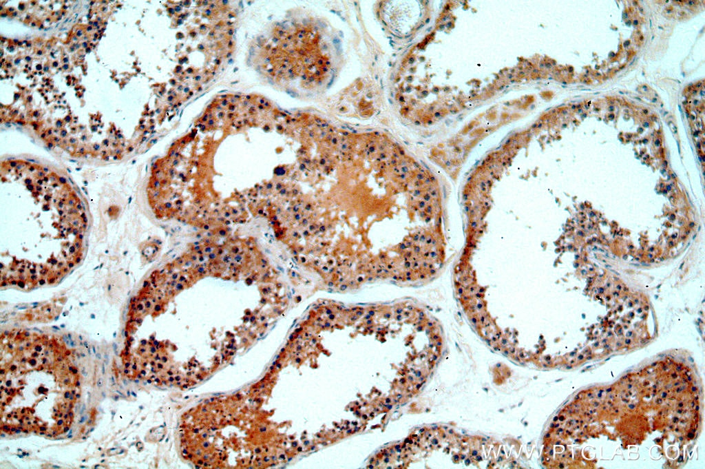 Immunohistochemistry (IHC) staining of human testis tissue using MYO16 Polyclonal antibody (18828-1-AP)