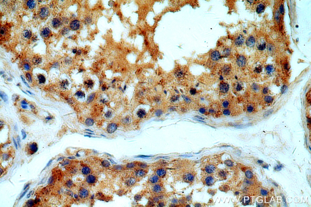Immunohistochemistry (IHC) staining of human testis tissue using MYO16 Polyclonal antibody (18828-1-AP)