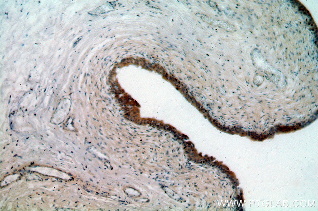 Immunohistochemistry (IHC) staining of human bladder tissue using MYO16 Polyclonal antibody (18828-1-AP)