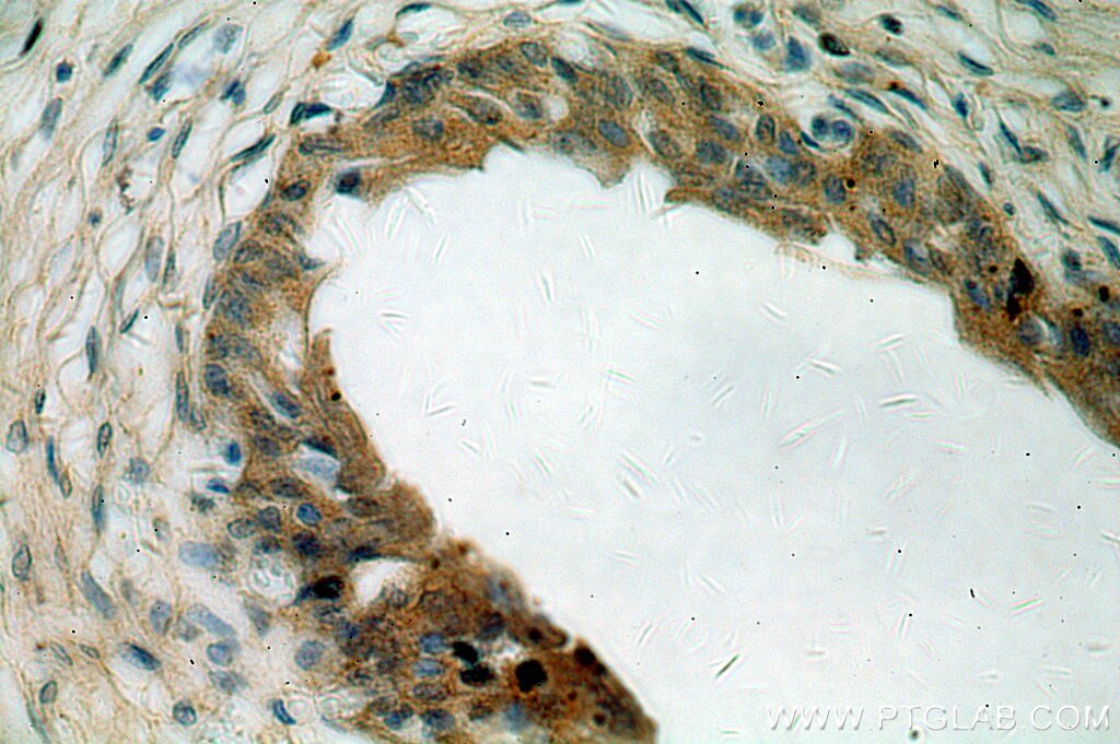 Immunohistochemistry (IHC) staining of human bladder tissue using MYO16 Polyclonal antibody (18828-1-AP)