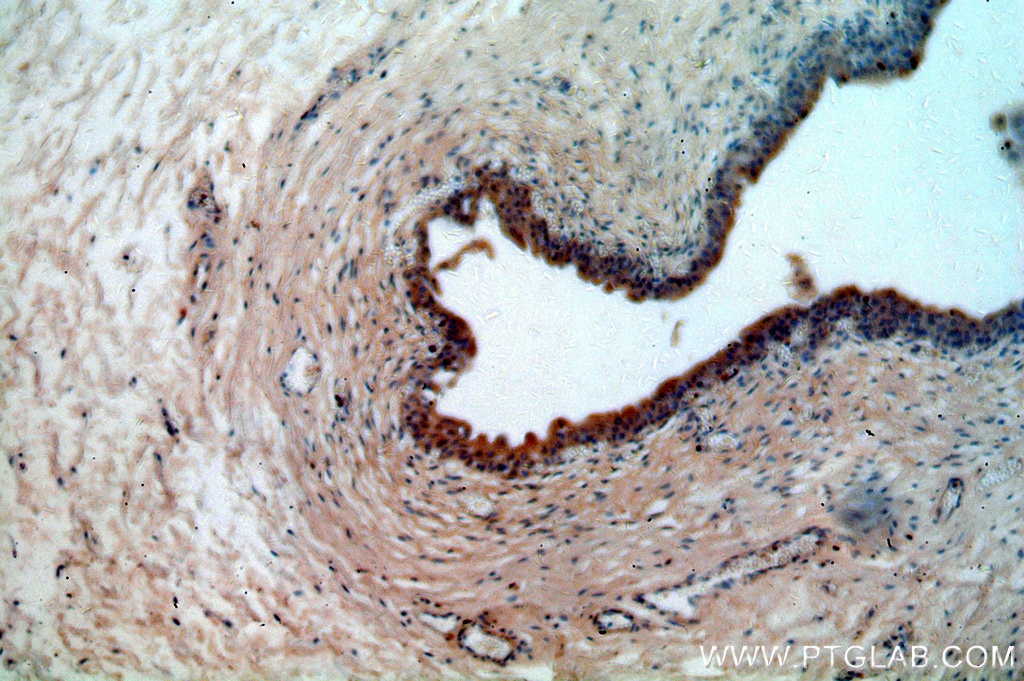 IHC staining of human bladder using 18828-1-AP