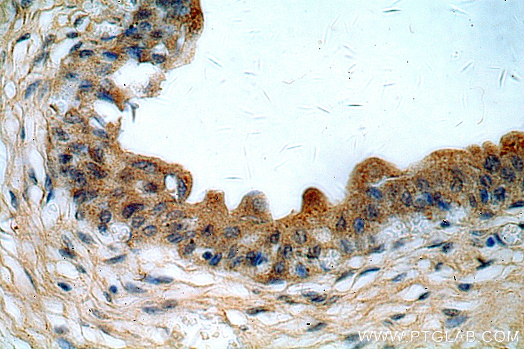 Immunohistochemistry (IHC) staining of human bladder tissue using MYO16 Polyclonal antibody (18828-1-AP)