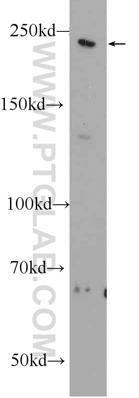 Western Blot (WB) analysis of rat brain tissue using MYO16 Polyclonal antibody (25104-1-AP)