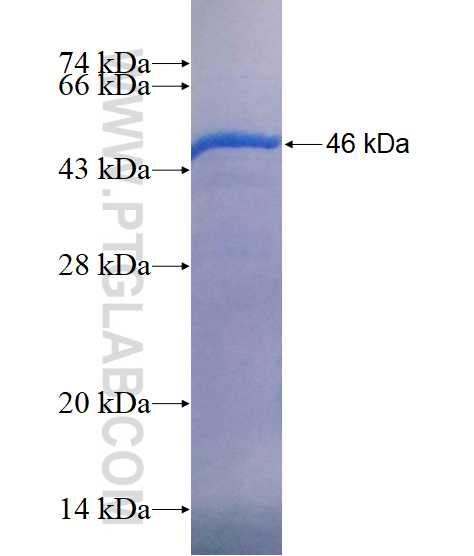 MYO16 fusion protein Ag18798 SDS-PAGE