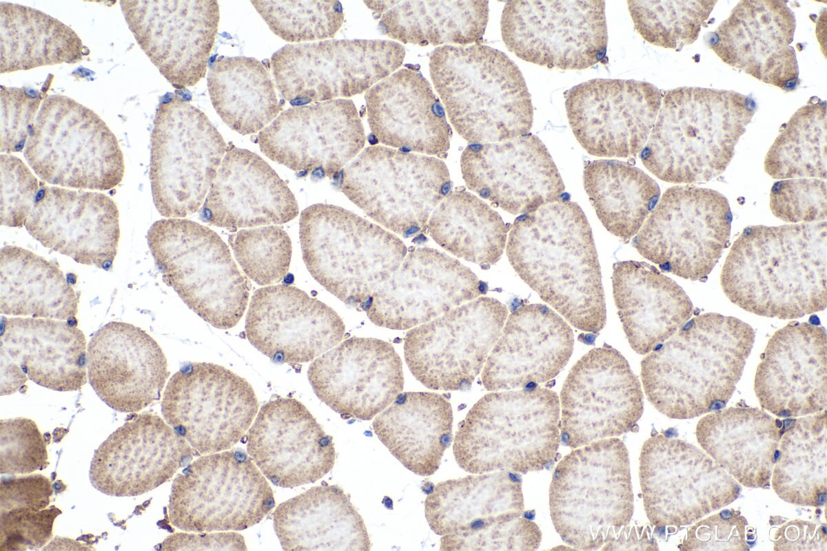 Immunohistochemistry (IHC) staining of mouse skeletal muscle tissue using MYO18A Polyclonal antibody (14611-1-AP)