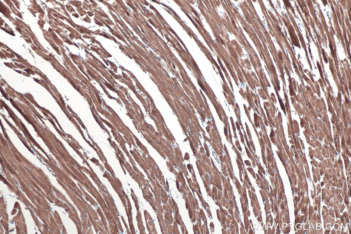 IHC staining of mouse heart using 14611-1-AP