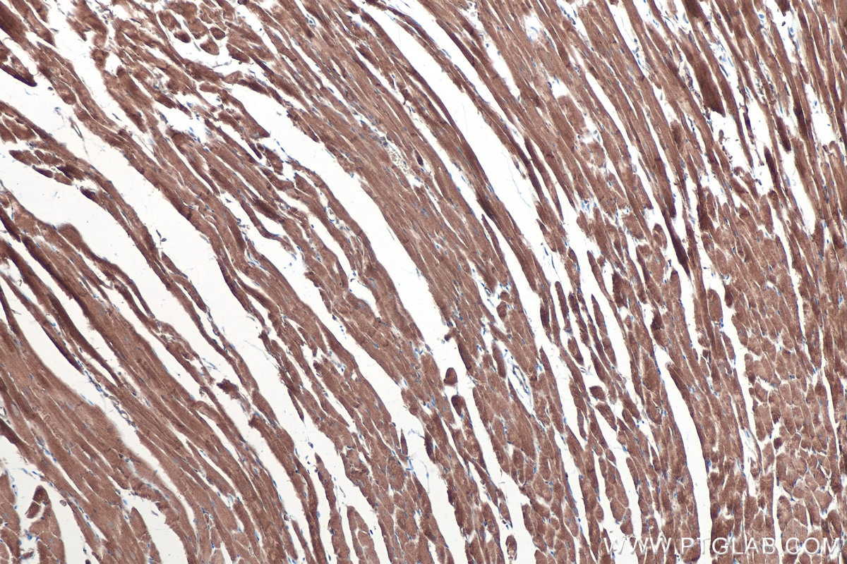 Immunohistochemistry (IHC) staining of mouse heart tissue using MYO18A Polyclonal antibody (14611-1-AP)