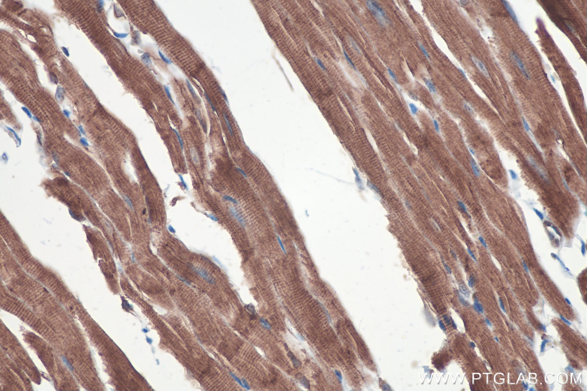 Immunohistochemistry (IHC) staining of mouse heart tissue using MYO18A Polyclonal antibody (14611-1-AP)