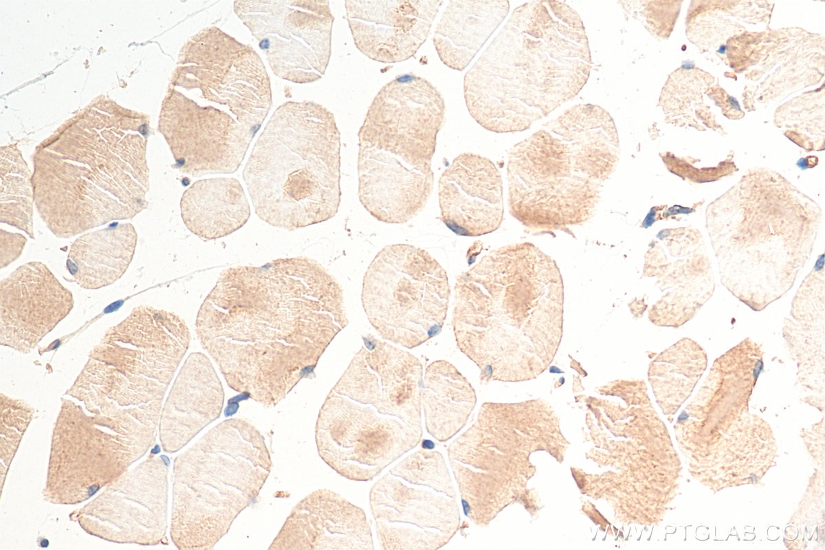 Immunohistochemistry (IHC) staining of mouse skeletal muscle tissue using MYO18A Polyclonal antibody (14611-1-AP)