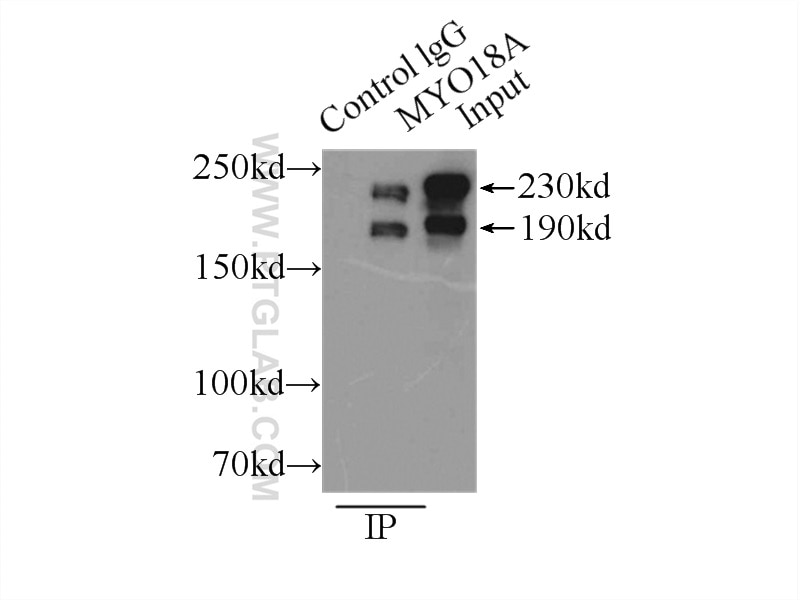 Immunoprecipitation (IP) experiment of HeLa cells using MYO18A Polyclonal antibody (14611-1-AP)