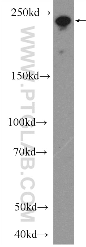 Western Blot (WB) analysis of NIH/3T3 cells using MYO18A Polyclonal antibody (14611-1-AP)