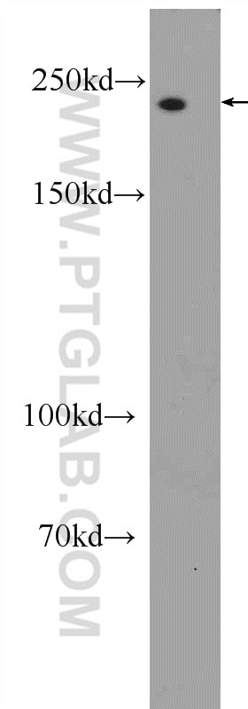 Western Blot (WB) analysis of Neuro-2a cells using MYO18A Polyclonal antibody (14611-1-AP)