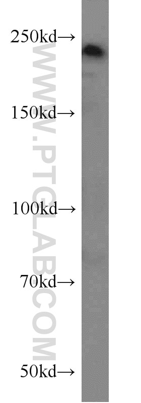 Western Blot (WB) analysis of K-562 cells using MYO18A Polyclonal antibody (14611-1-AP)