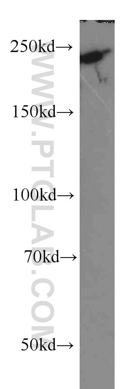 Western Blot (WB) analysis of HeLa cells using MYO18A Polyclonal antibody (14611-1-AP)