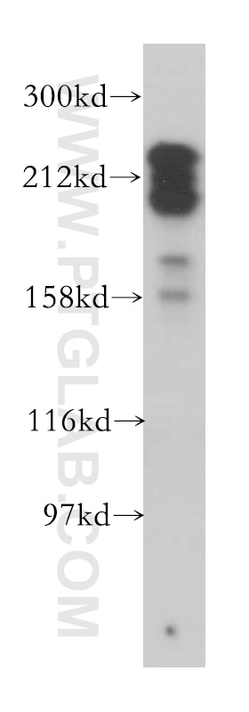 Western Blot (WB) analysis of HeLa cells using MYO18A Polyclonal antibody (14611-1-AP)