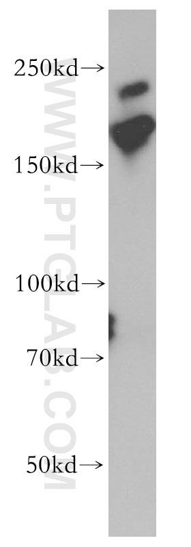 Western Blot (WB) analysis of Jurkat cells using MYO18A Polyclonal antibody (14611-1-AP)