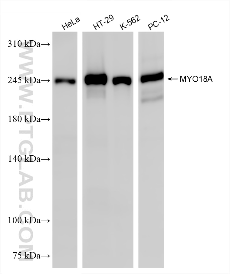 Western Blot (WB) analysis of various lysates using MYO18A Recombinant monoclonal antibody (87218-4-RR)