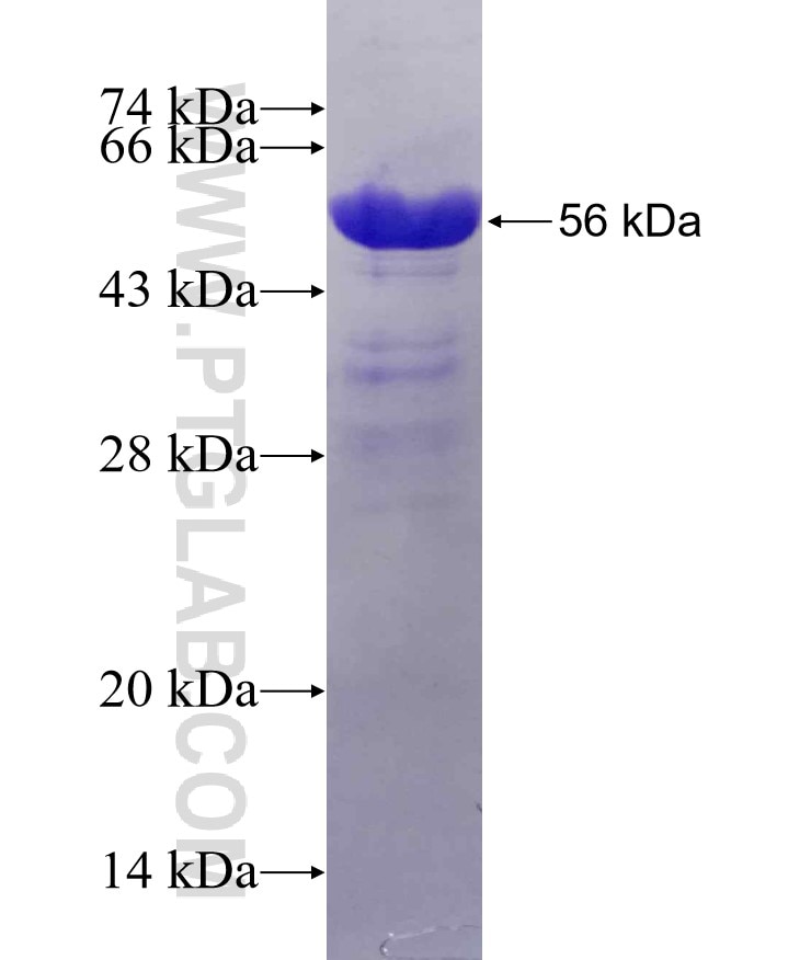 MYO18A fusion protein Ag6185 SDS-PAGE