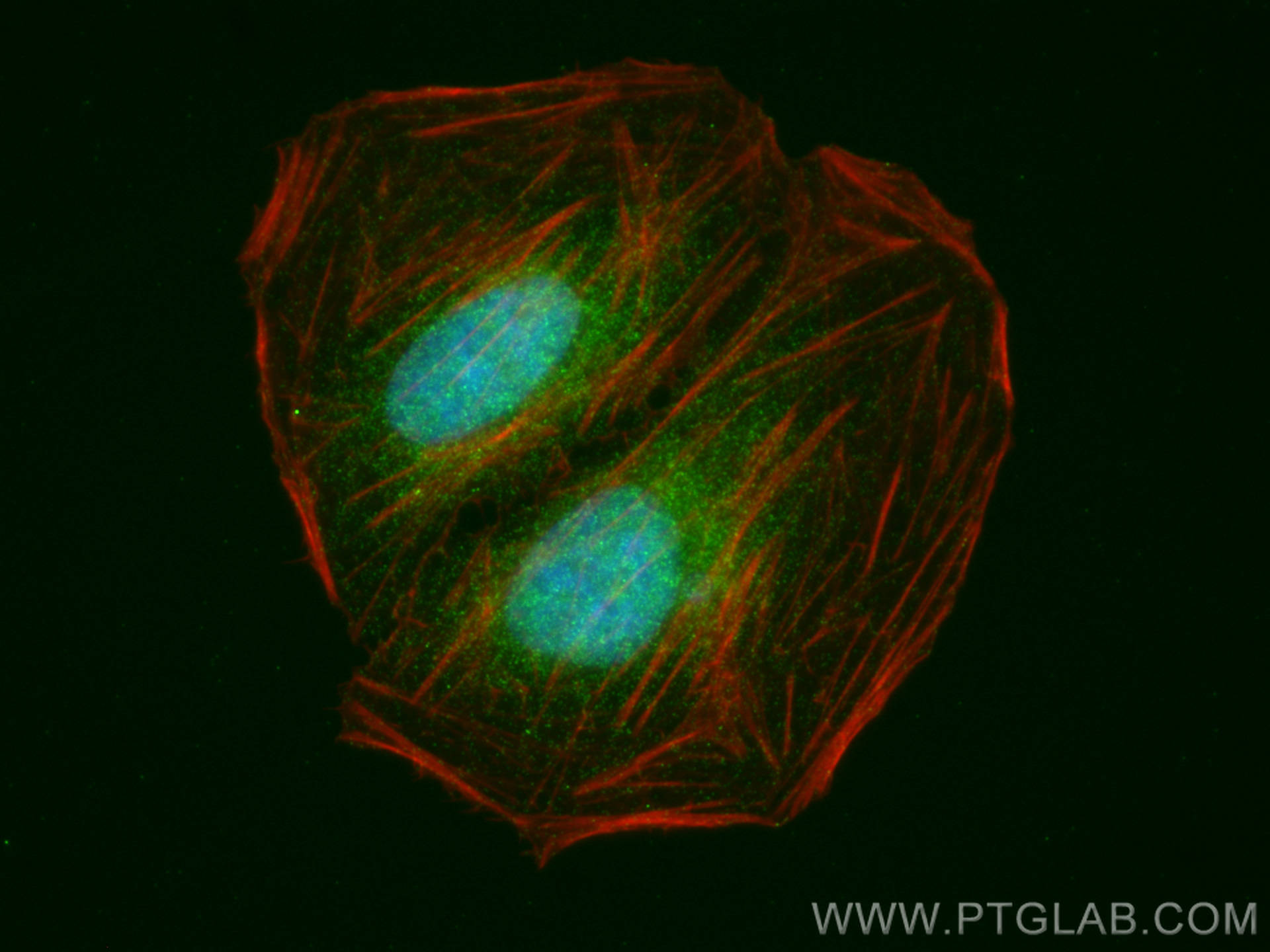 Immunofluorescence (IF) / fluorescent staining of U2OS cells using MYO18B Polyclonal antibody (25691-1-AP)