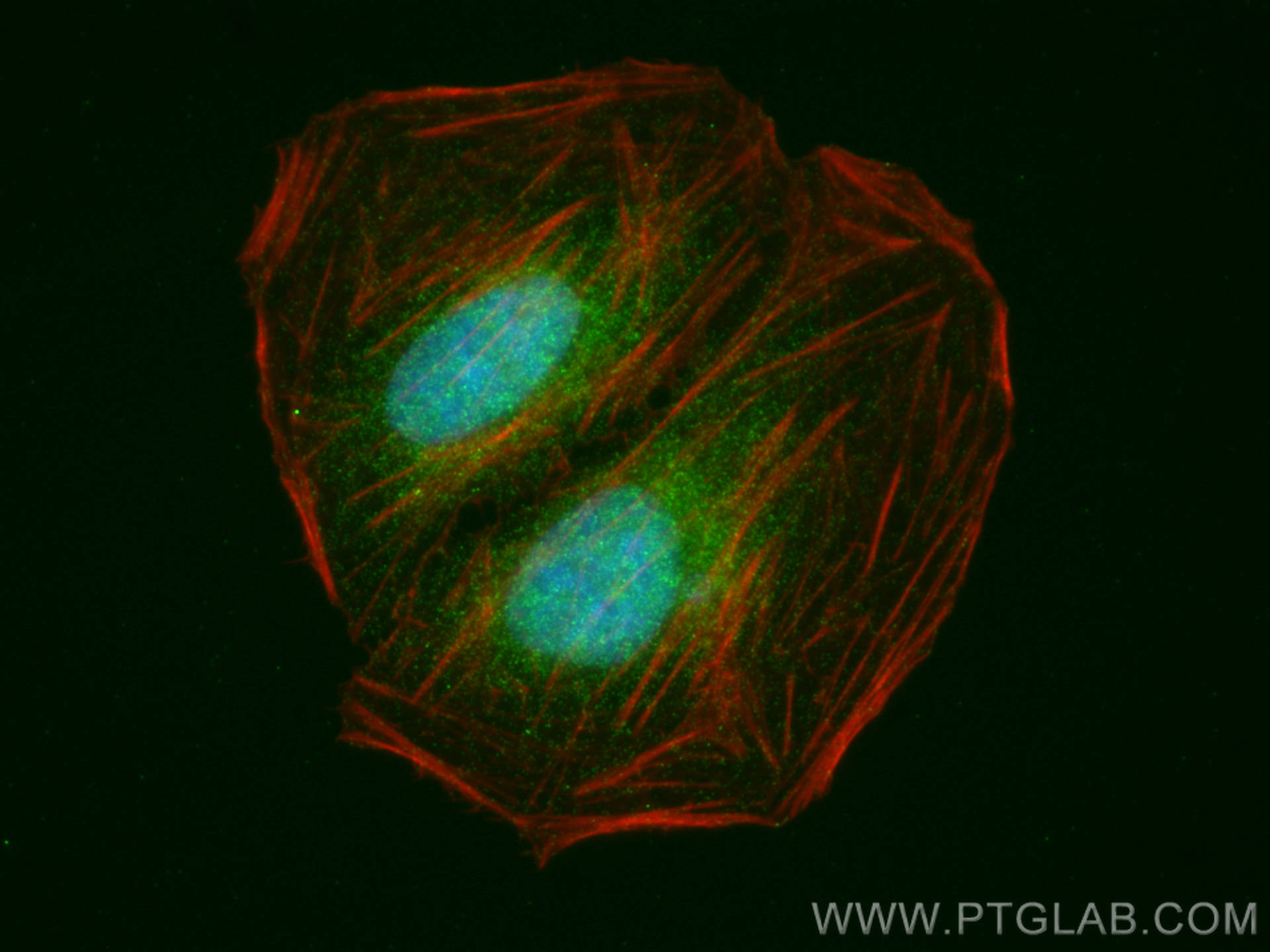 IF Staining of U2OS using 25691-1-AP