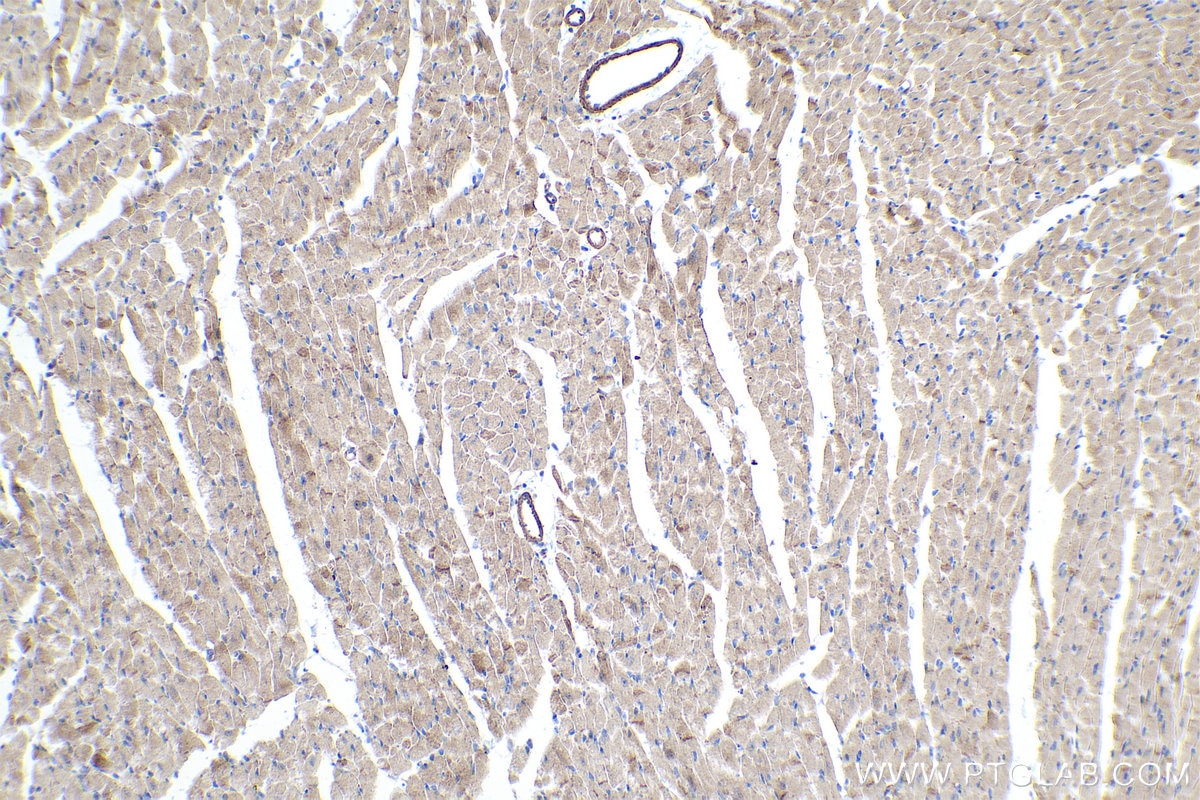 Immunohistochemistry (IHC) staining of mouse heart tissue using MYO18B Polyclonal antibody (25691-1-AP)