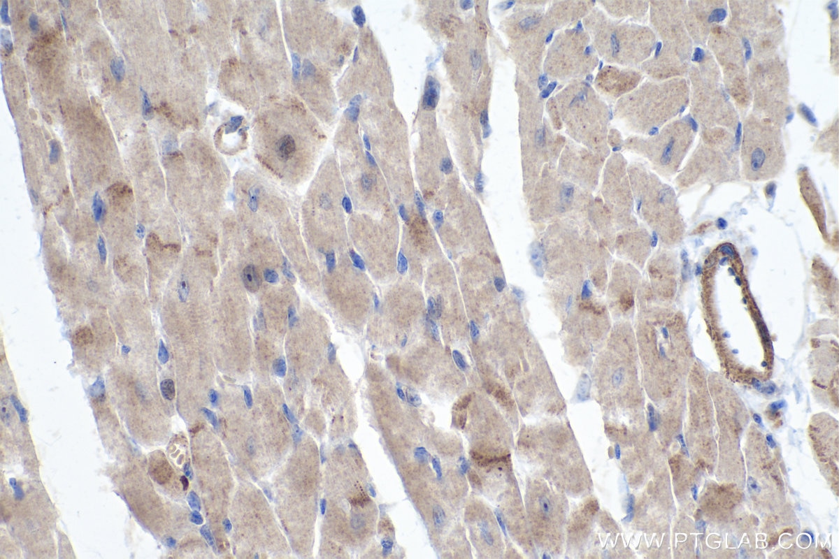 Immunohistochemistry (IHC) staining of mouse heart tissue using MYO18B Polyclonal antibody (25691-1-AP)
