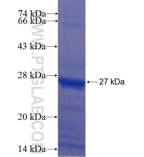 MYO18B fusion protein Ag22454 SDS-PAGE