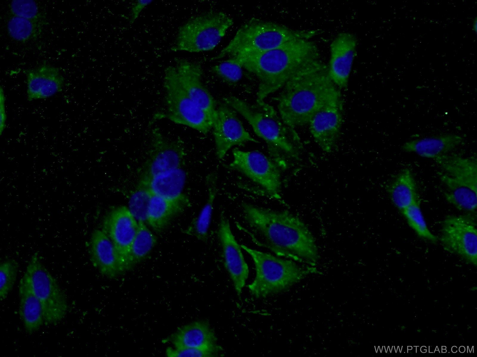Immunofluorescence (IF) / fluorescent staining of A549 cells using MYO19 Polyclonal antibody (23906-1-AP)